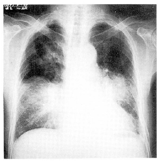 Amiodarone Toxicity Testing