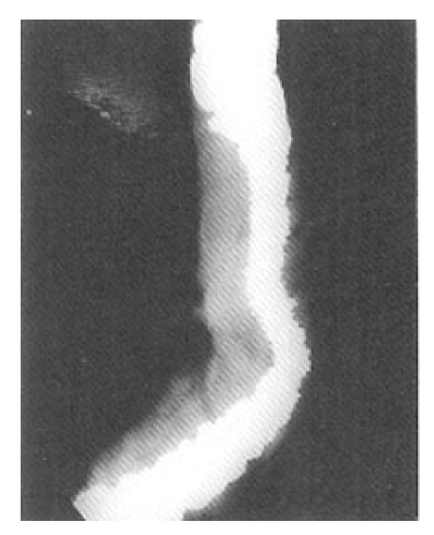 kjim-13-1-56-10f2.gif