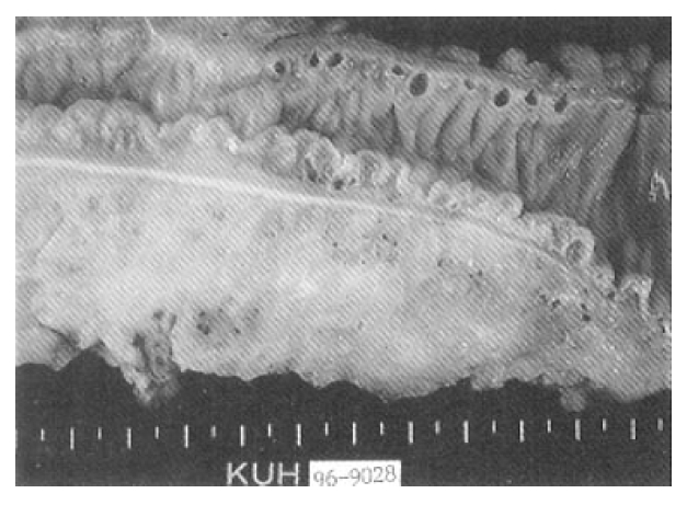kjim-13-1-56-10f3.gif