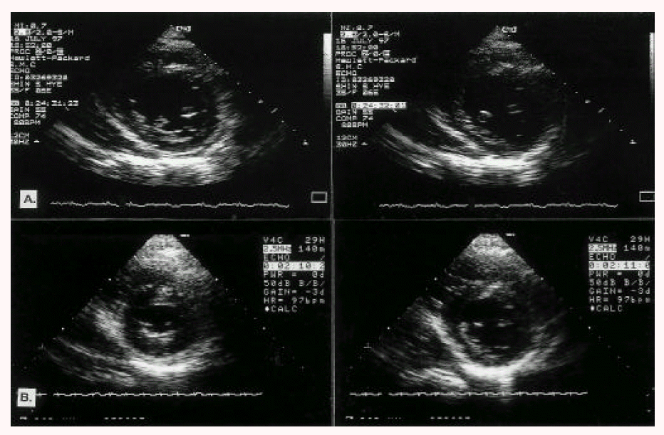 kjim-13-2-117-8f2.gif