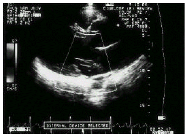 kjim-13-2-140-13f3.gif