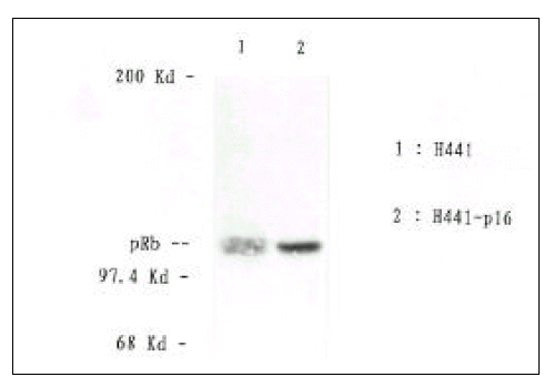 kjim-14-1-53-8f3.gif