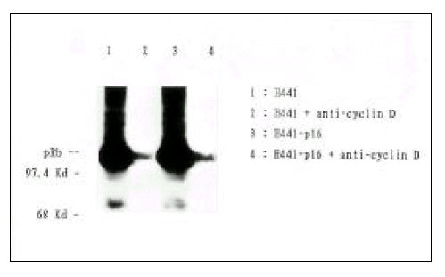 kjim-14-1-53-8f5.gif