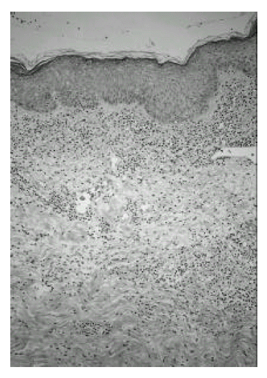 kjim-14-2-78-12f3.tif