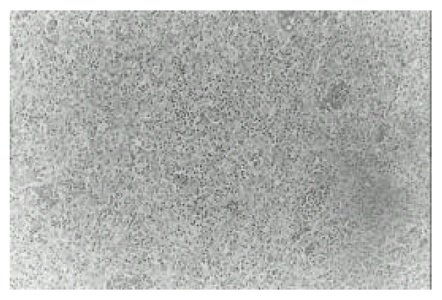 kjim-15-2-151-11f3.tif