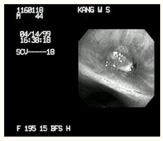 kjim-15-3-240-12f3.gif