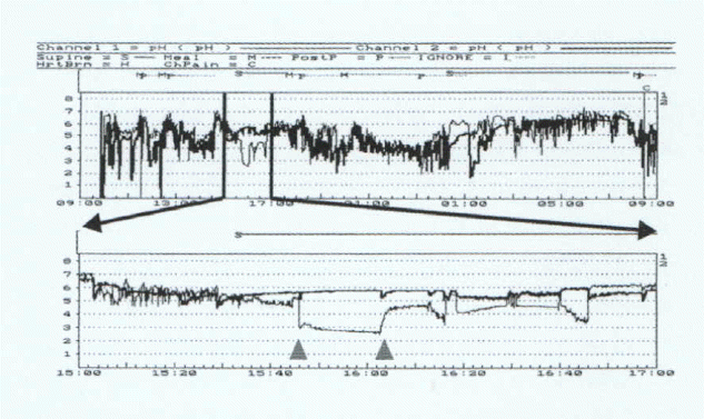 kjim-16-1-14-3f2.tif