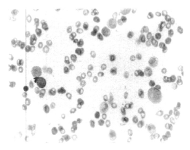 kjim-19-3-193-10f1.tif