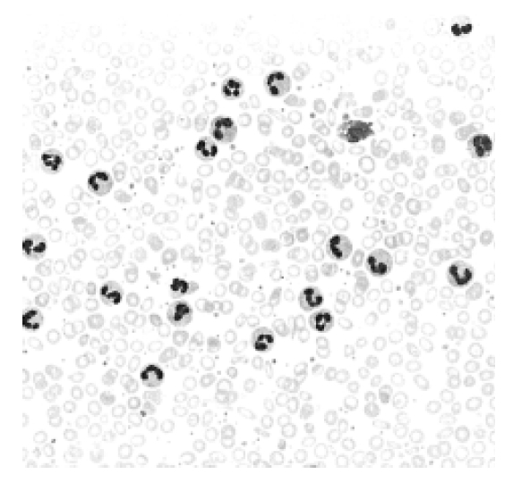 kjim-19-4-285-14f1.gif
