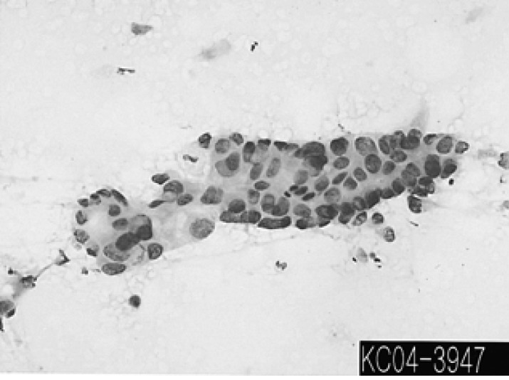 kjim-20-86-g003