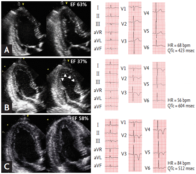 Septic cardiomyopathy: Diagnosis and management☆