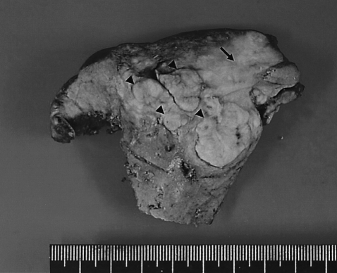 kjim-22-283-g004.jpg