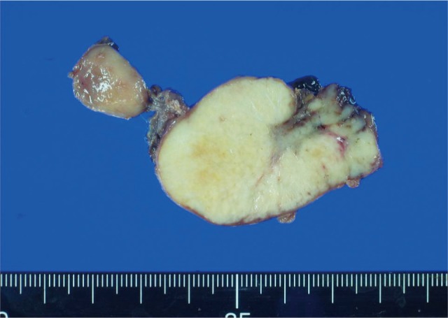 kjim-27-459-g002.jpg