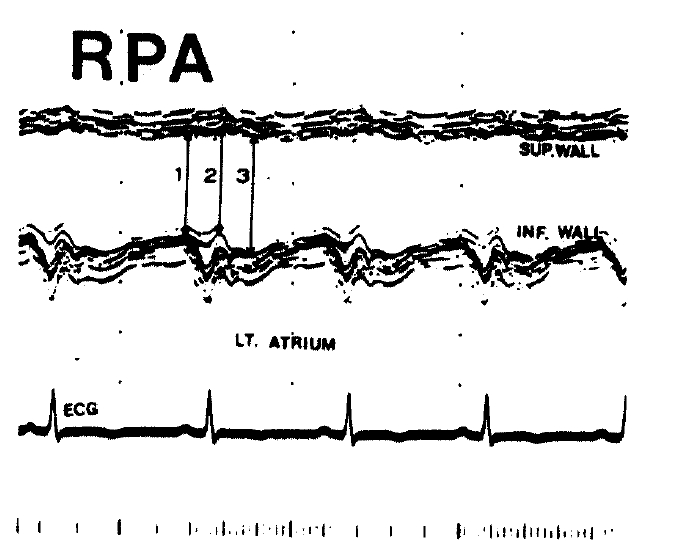 kjim-4-2-148-8f1.tif