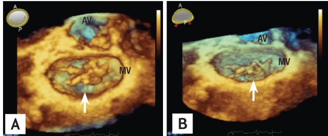 Figure 15